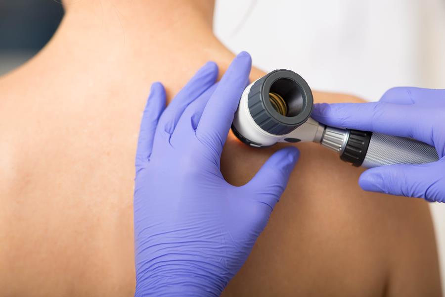 Tele-expertise dermatologie terugbetaald